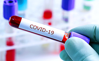 MZ: ponad 15 tys. zakażeń koronawirusem, zmarły 163 osoby z COVID-19